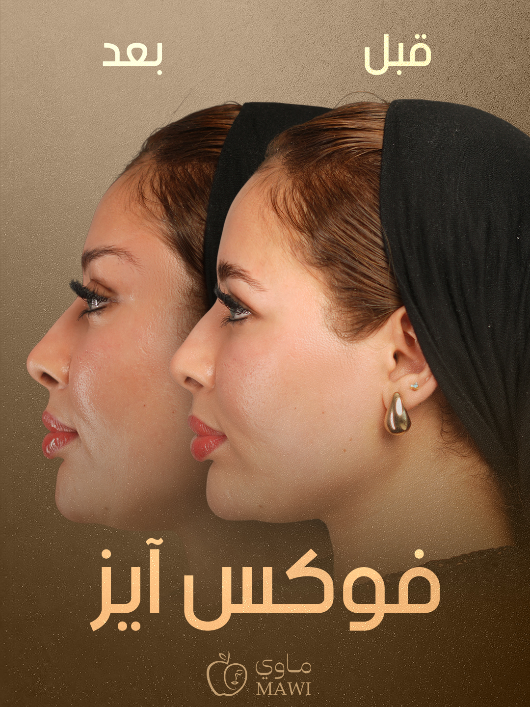 Facial result