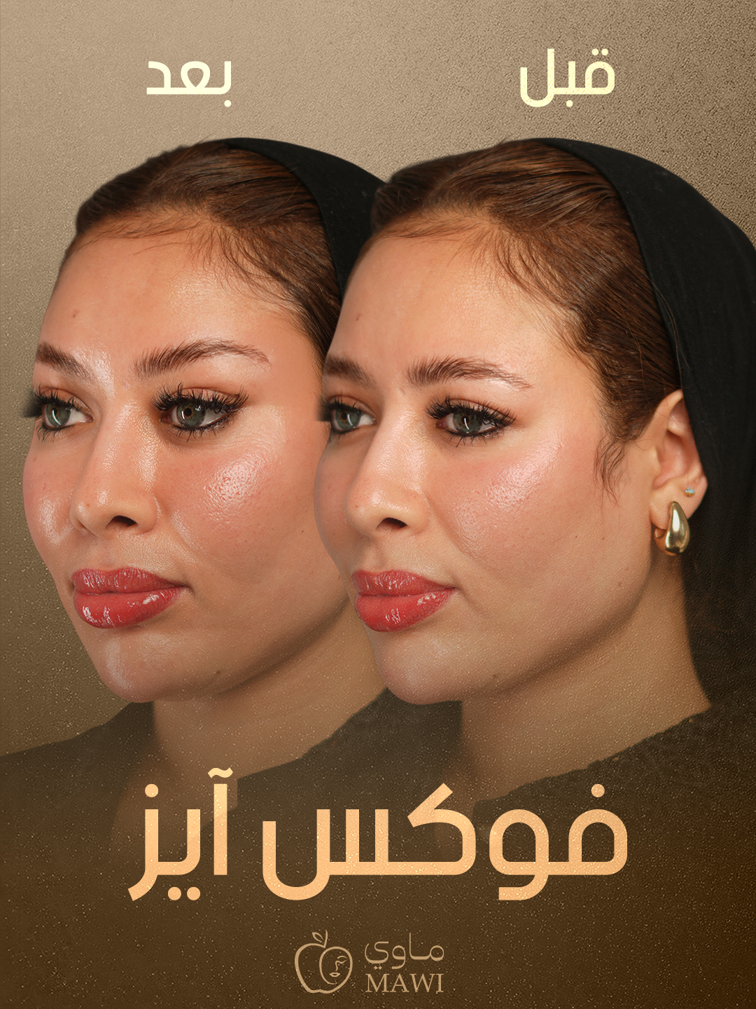 Facial result
