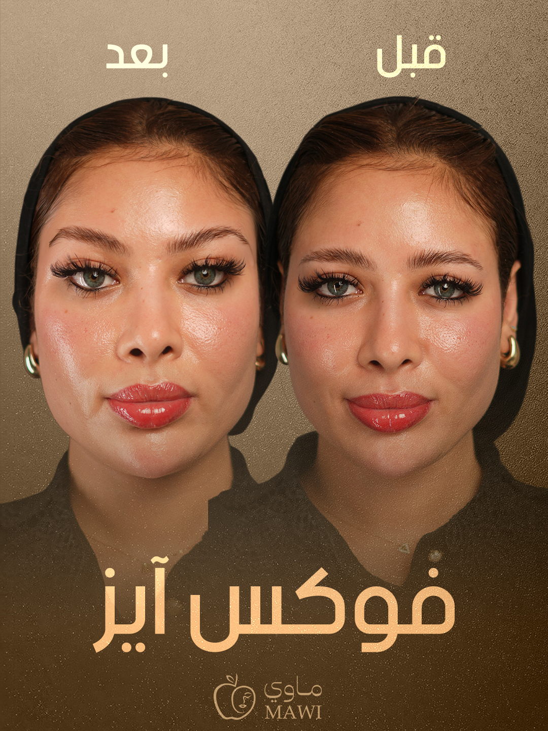 Facial result