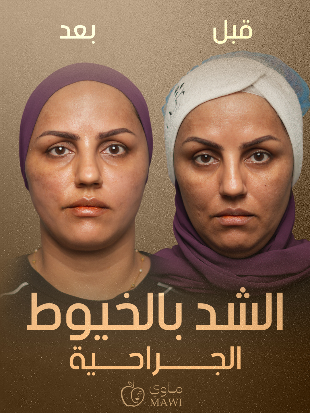 Facial result