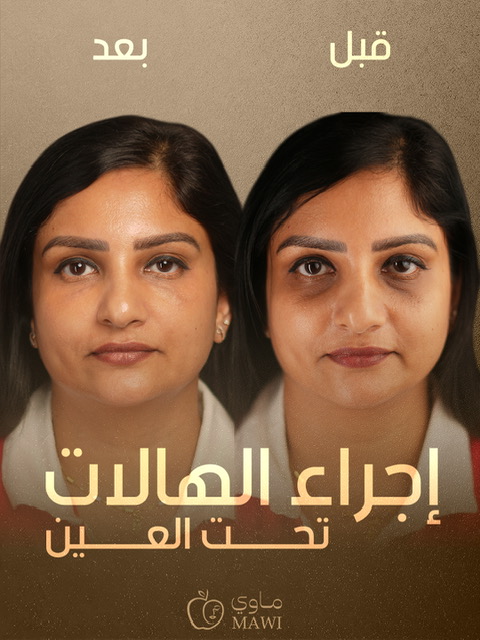 Facial result